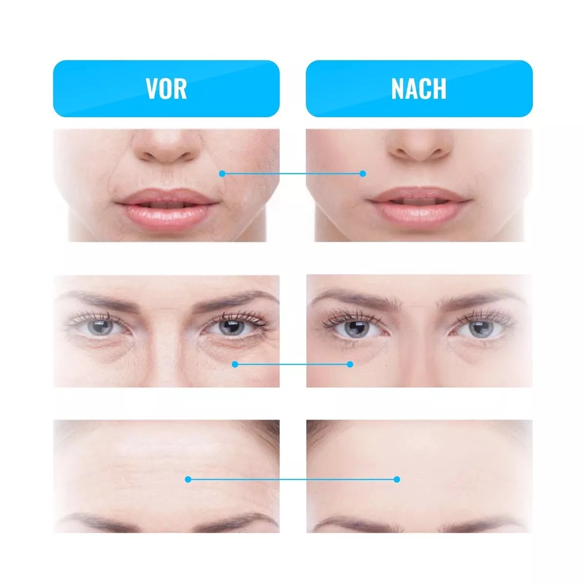 میکروکارنت خانگی